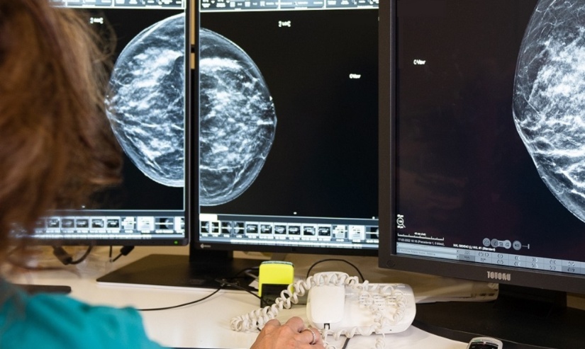screening-mammografia-breast